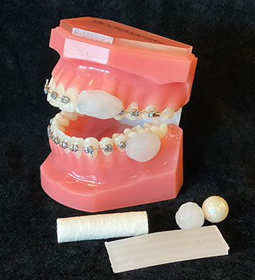 Loose Appliance, Bracket or Wire - Charles C. Low Orthodontics