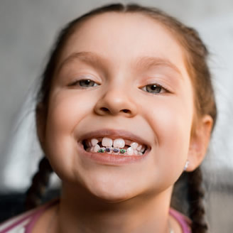 early orthodontic treatment