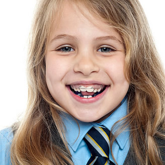 orthodontic retention